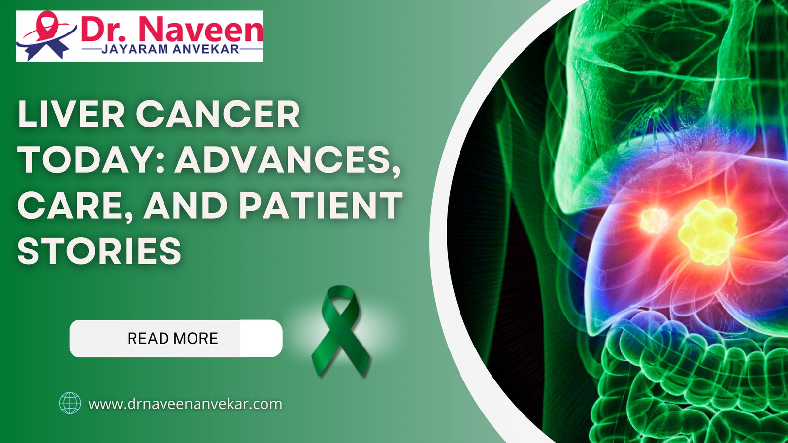 Liver Cancer Today: Advances, Care, and Patient Stories